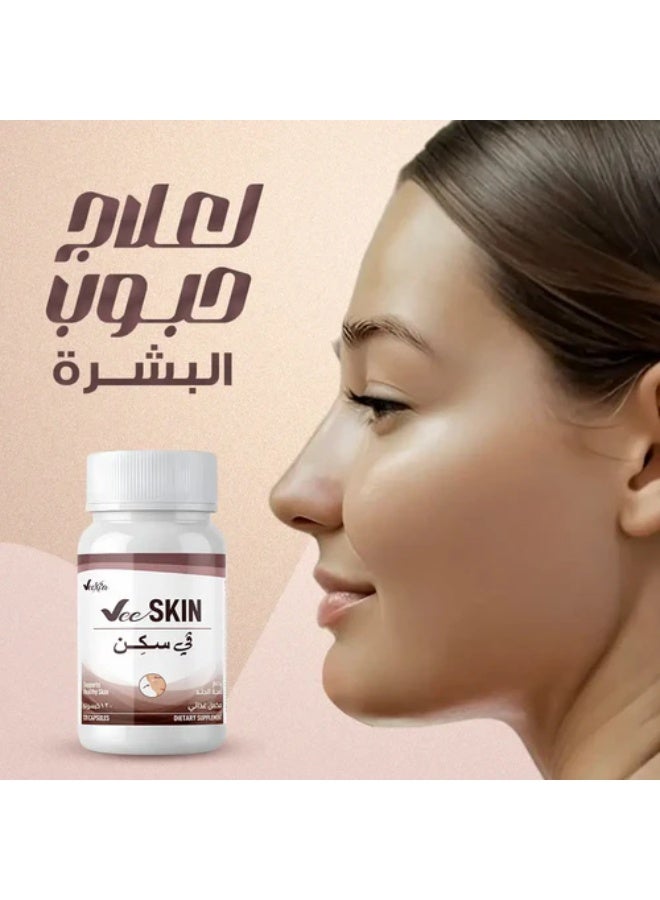 فيكسيا في سكين فيتامين B5 (حمض البانتوثينيك) 500 ملجم لتقليل حب الشباب  - 30 كبسولة - Image 2