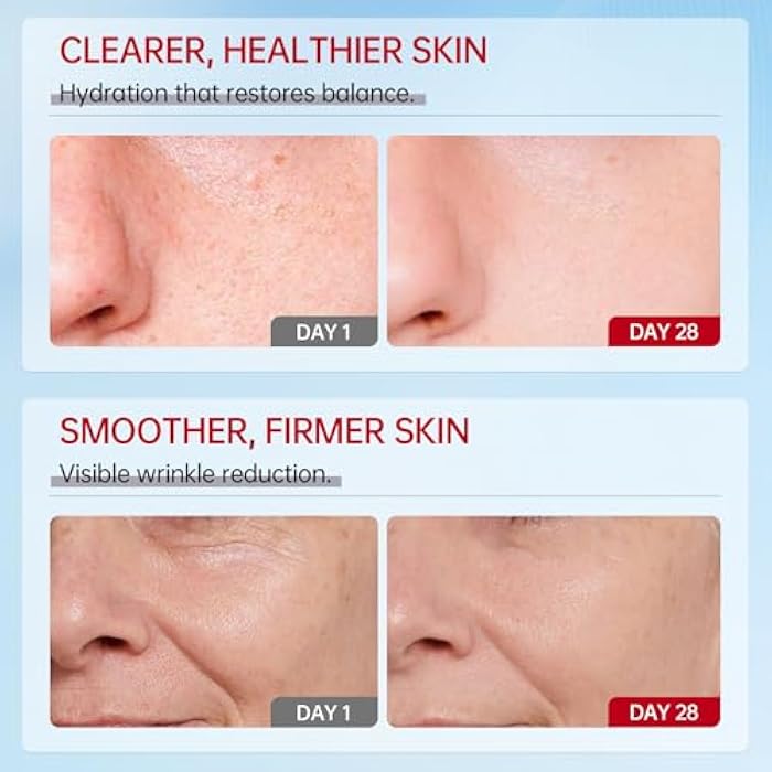 VGO Snail Mucin 92% Moisturizer Daily Face Moisturizer Hydrating Repair Face Gel Cream for Dry & Sensitive Skin, All Skin Types 50g / 1.76oz - Image 5