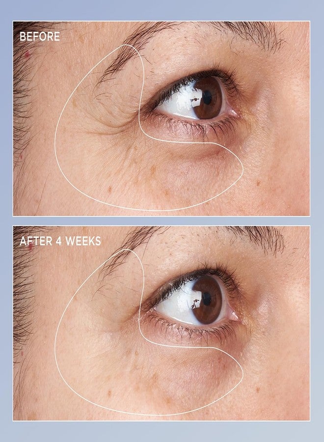 Perricone MD High Potency Triple Retinol Renewal Eye Serum, 0.5 fl. oz. - Image 3