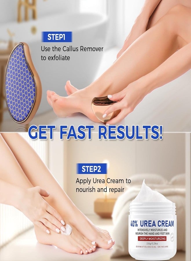 OUKEYA Urea Cream 40 Percent for Foot & Hand Cream with Foot Files for Dry Cracked,Urea Lotion for Feet Maximum Strength - Image 2