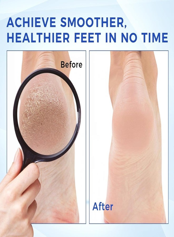 OUKEYA Urea Cream 40 Percent for Foot & Hand Cream with Foot Files for Dry Cracked,Urea Lotion for Feet Maximum Strength - Image 5