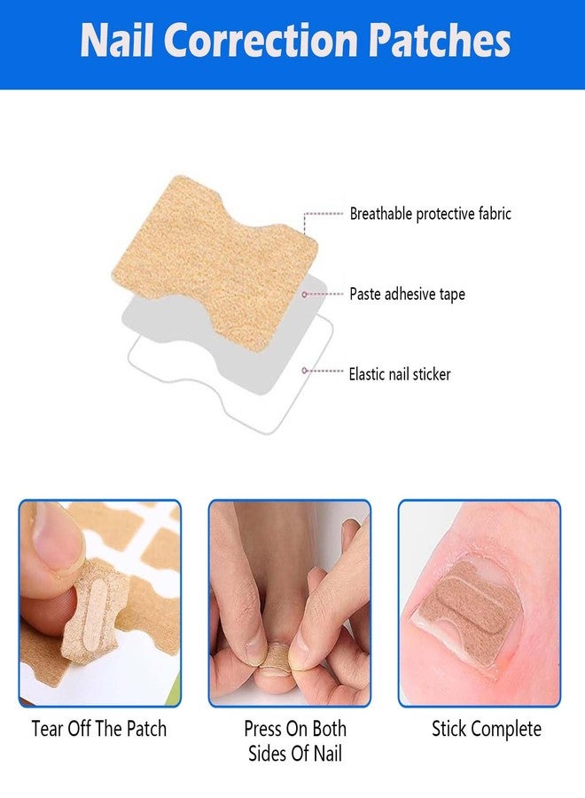Aeenioy 100 PCS Ingrown Toe Nail Remover, Toe Nail Corrector Kit with Nail Remover Pads, Toenail Correction Patch for Ingrown Toenail Pain Relief, Daily Nail Care and Post-Exercise Maintenance - Image 4