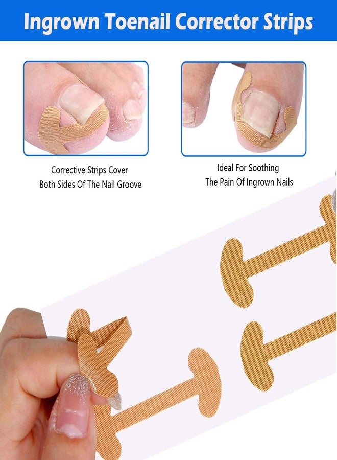 Aeenioy 100 PCS Ingrown Toe Nail Remover, Toe Nail Corrector Kit with Nail Remover Pads, Toenail Correction Patch for Ingrown Toenail Pain Relief, Daily Nail Care and Post-Exercise Maintenance - Image 5