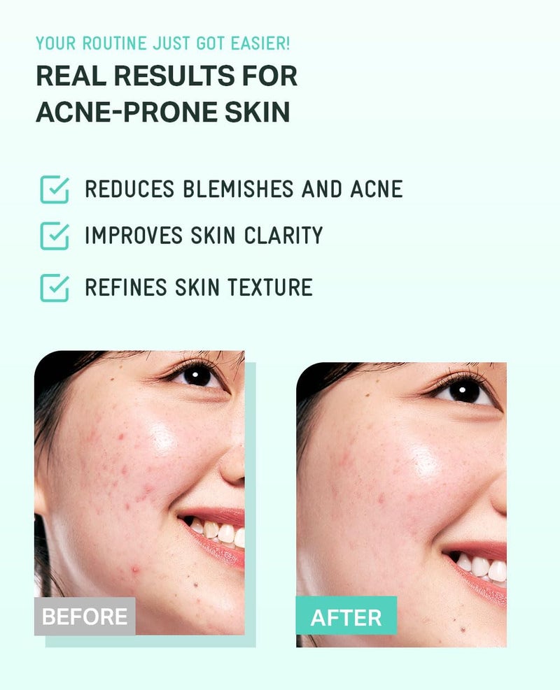 BRING GREEN Tea Tree Cica Soothing Cream Plus 100ml Korean Skin care, calming and soothing, moisturizer for skin, facial cream, trouble care, Blackhead Removing Pore care (Pack of 1) - Image 5