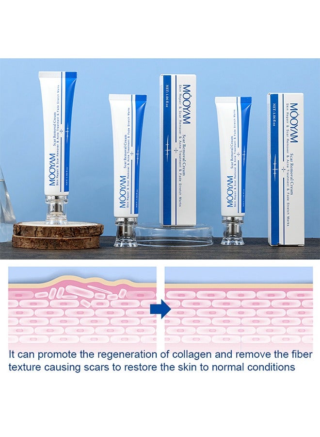 MOOYAM Scar Removal Cream, Skin Repairing Cream Fade Scars/Stretch Marks/Acne Treatment, Improve Scar Skin, Deeply Moisturizes Skin  - Image 5