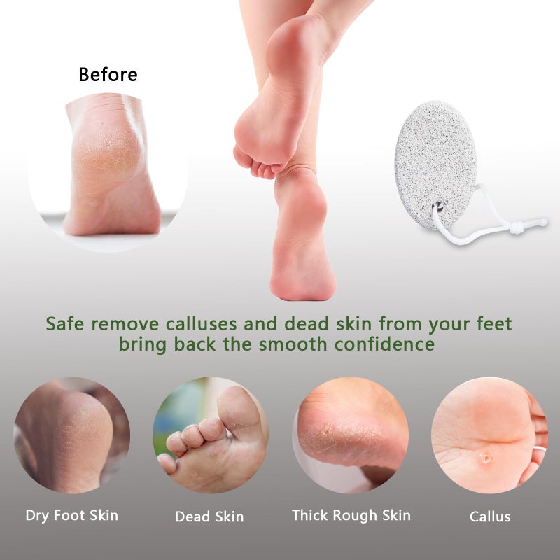 Borogo Natural Foot Pumice Stone for Feet, Borogo 2-Pack Lava Pedicure Tools Hard Skin Callus Remover for Feet and Hands - White - Image 4