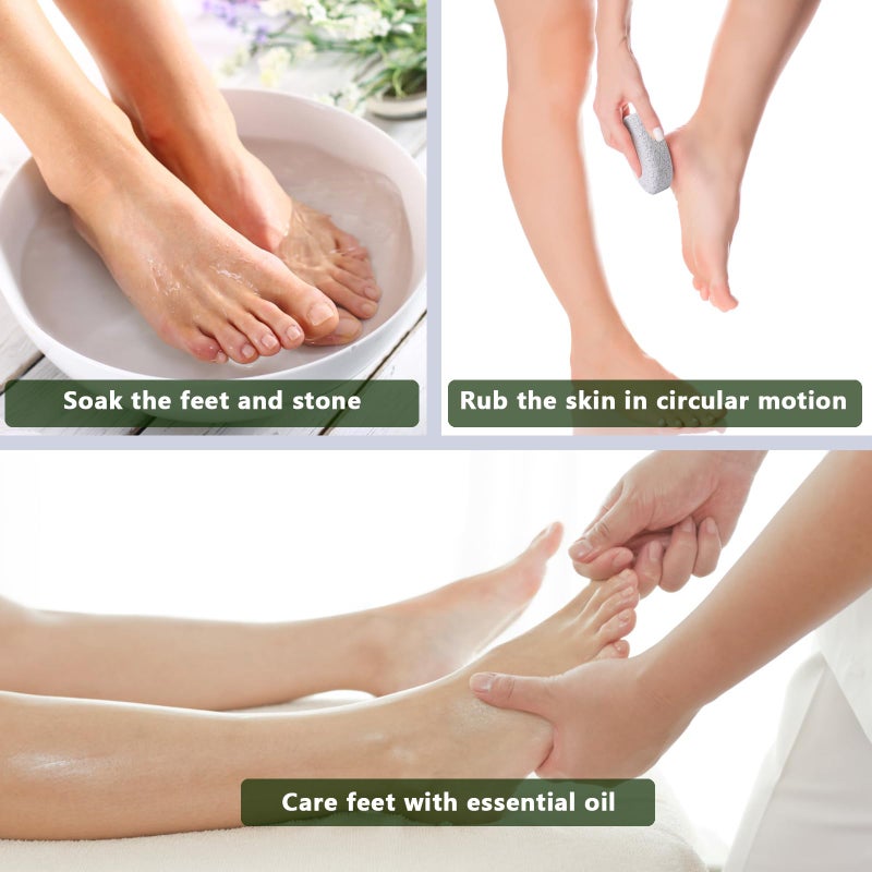Borogo Natural Foot Pumice Stone for Feet, Borogo 2-Pack Lava Pedicure Tools Hard Skin Callus Remover for Feet and Hands - White - Image 3