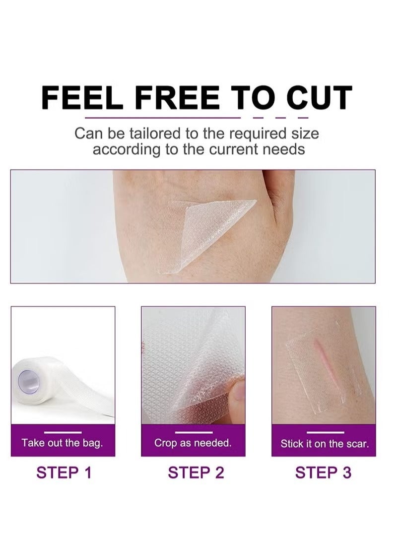 elai mei Clear Silicon Scar Sheets, Scar Away Scar Tape(1.6” x 60”Roll-1.5M), Scar Strips for Surgical Scars, Medical Grade, Invisible, Scar Removal Sheets for C-Section, Breast, Burn, Keloid, Acne et - Image 4