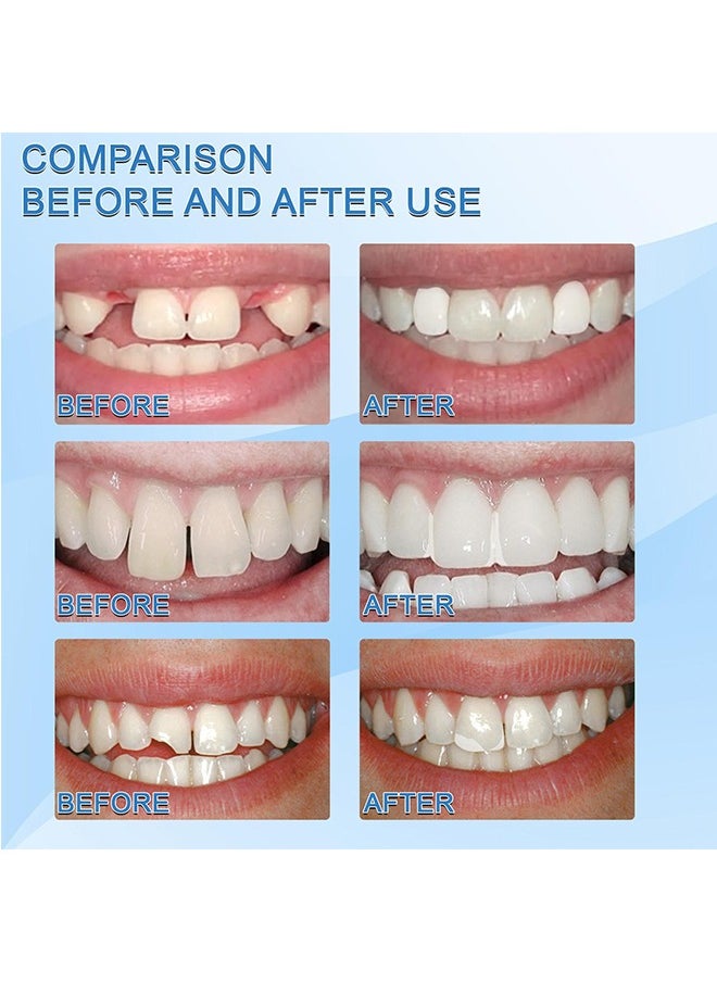 Jaysuing Moldable False Teeth,Denture Modification Teether，Shapeable Teether, Flexible Denture Adhesive for Custom Fit, Film and Television Makeup,Suitable for Temporary Filling  - Image 3