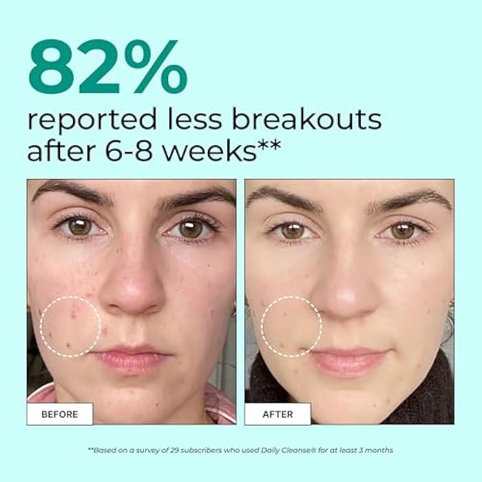 HUM Daily Cleanse Acne Supplements for Women & Men, Gentle Digestive Cleanse for Clear Skin Support, Zinc, Spirulina, Chlorella, Detoxifying Herbs, Organic Algae, Skin Vitamins Supplement, 60 Capsules - Image 3