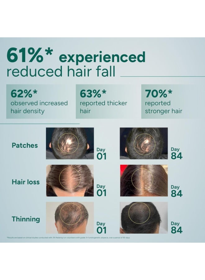 Arata Hair Growth Serum for Scalp for Faster Hair Growth & Stronger Roots | Helps Reduce Hair Fall | Derma Tested | With 3% Redensyl, 3% Procapil & 3% Kopexil | For Women & Men 30ml - Image 2