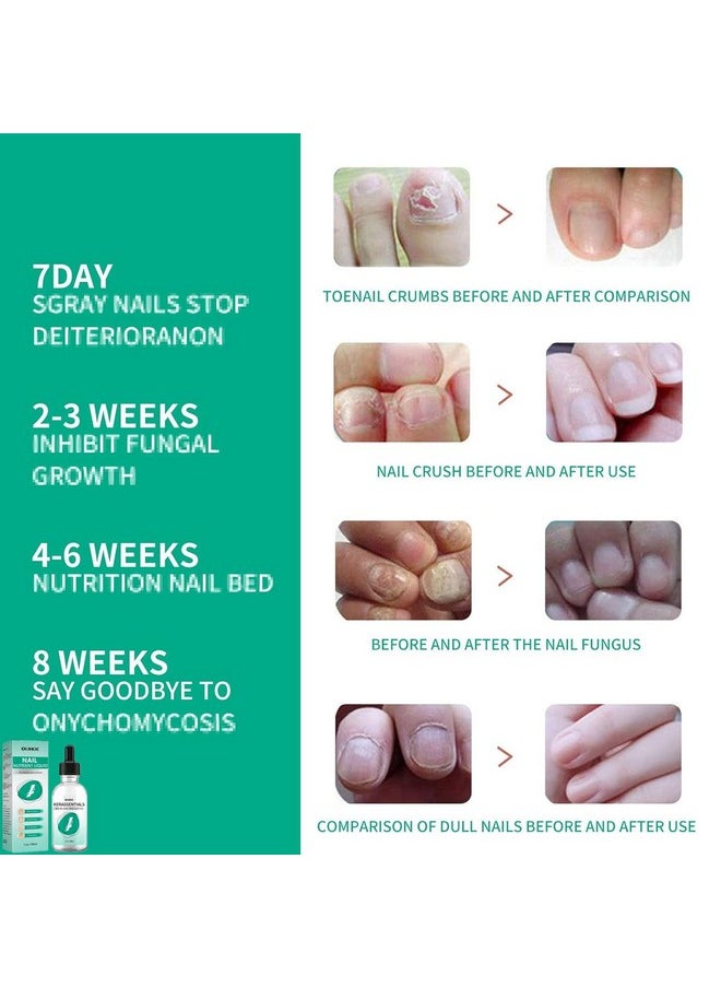 MUBSEOTH - Kerassentials Toenail Oil Kerassentials Nails Colourless (3Pcs) - Image 1