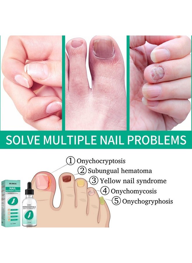 MUBSEOTH - Kerassentials Toenail Oil Kerassentials Nails Colourless (3Pcs) - Image 1