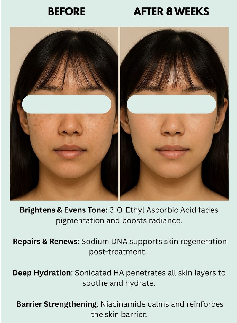 BONITTO® GIHA 2-Piece Needle-Free Skin Brightening Booster with 3-O-Ethyl Ascorbic Acid, Niacinamide, Sodium DNA (PDRN) & Sodium Hyaluronate – 0.5ml + 1.5ml | Vitamin C Glow Serum, Anti-Aging, Hydrating Spot Corrector  - Image 3