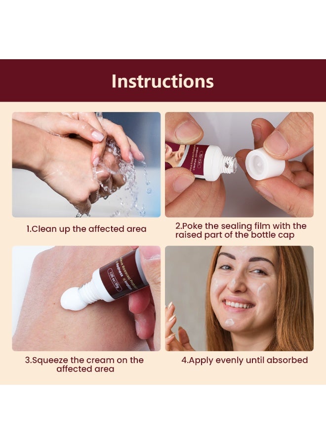 Rosacea Care كريم علاج الوردية للوجه تخفيف احمرار الأنف احمرار حب الشباب 30 جرام - Image 2