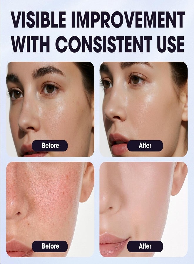 Bmrewax Arbutin 8% + Tranexamic Acid 5% Cream for Dark Spots, Uneven Skin Tone & Discoloration, Brightening Face Cream with Niacinamide, Glutathione & Hyaluronic Acid, Hydrating Formula for Sensitive Skin - Image 4