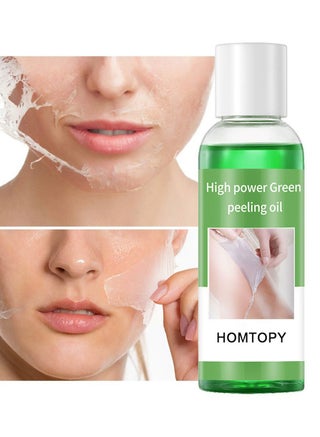 Peeling Oil for Dark Skin,Green Extra Strength Exfoliating Body Peeling Oil,Chemical Peel Solution for Hands and Feet,Effective Exfoliation for Smooth and Radiant Skin - pzsku/Z50B7FC01D6E82F47B74EZ/45/1743410993/d9dc7298-805f-4ab1-84fe-e8dd3a082321
