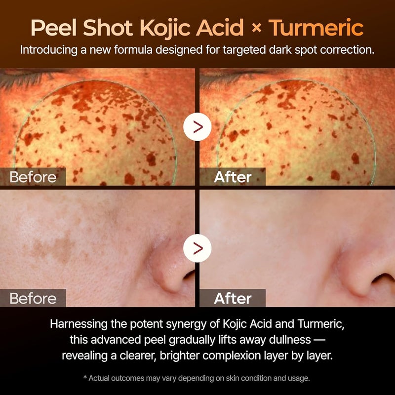 Dr. Melaxin Dr.Melaxin Peel Shot Kojic Acid Turmeric Serum – Exfoliating Dark Spot Corrector with AHA/BHA & Niacinamide, Brightening & Even Tone Facial Serum (80ml / 2.70 fl oz) - Image 3