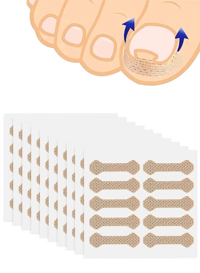 Ingrown Toenail Treatment, 100 Pcs Breathable Ingrown Toenail Strips,Painless Ingrown Toenail Tool, Professional Pedicure for Toenail Corrector Patch - Image 1