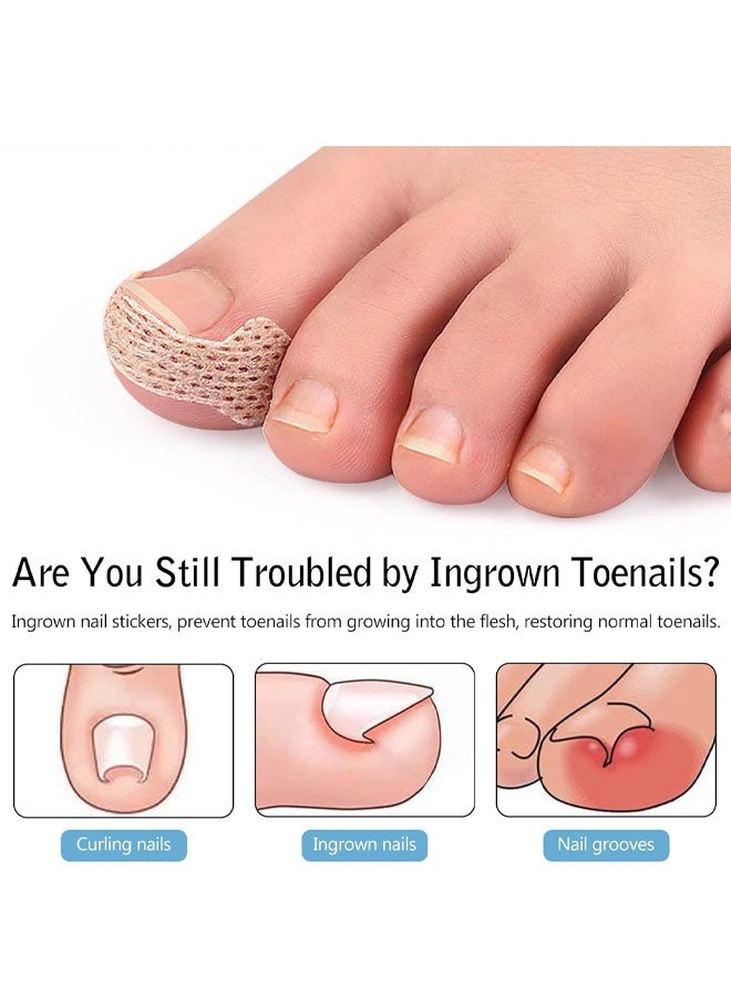 Ingrown Toenail Treatment, 100 Pcs Breathable Ingrown Toenail Strips,Painless Ingrown Toenail Tool, Professional Pedicure for Toenail Corrector Patch - Image 3