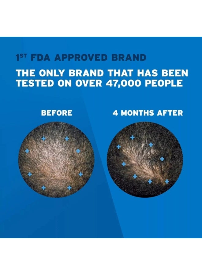 ريجين علاج إعادة نمو الشعر للرجال برغوة مينوكسيديل ٥٪؜ الموضعية، عبوة تكفي لمدة ٣ أشهر، ٢.١١ أونصة - Image 3