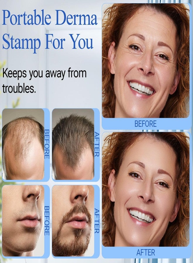 ANSIOVON Derma Stamp - ANSIOVON Microneedling Stamp for Hair Face Scalp Beard - Microneedle Dermastamp at Home - Micro Needling Stamp for Women and Men - Image 5