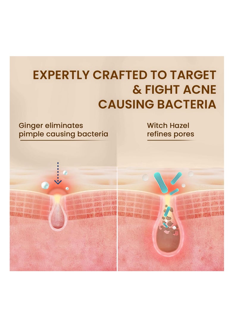 Skin Story Clean Beauty The Skin Story Ginger Cinnamon Face Wash Removes Pimple Germs Reduces Dark Spots and Minimizes Pores  - Image 3