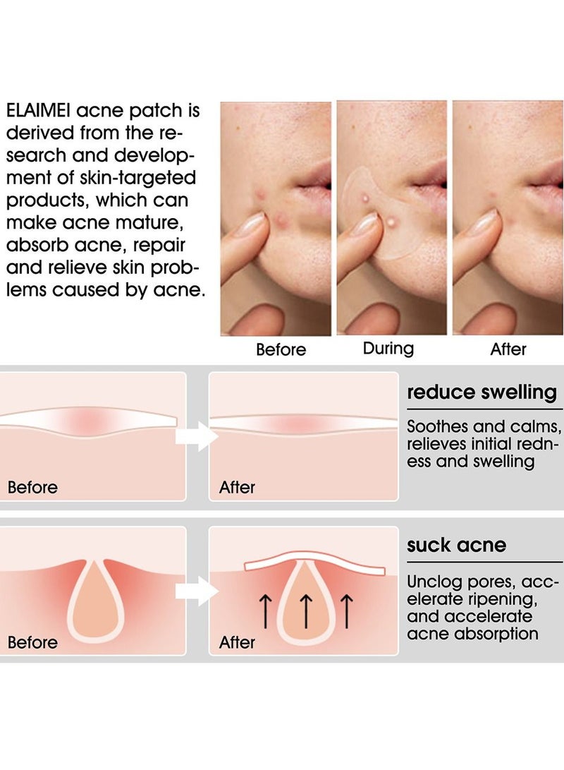 Elaimei 20-Piece Hydrocolloid Tea Tree Oil Acne Patch  - Image 5