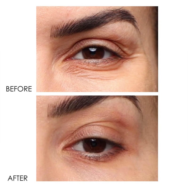 Dermelect Revitalite Eyelid & Dark Circle Corrector- Professional Strength, Anti-Aging Eye Cream with Peptides, Brightening & Tightening Ingredients- Dark Circles, Puffiness, Droopy Eyelids & Wrinkles - Image 3