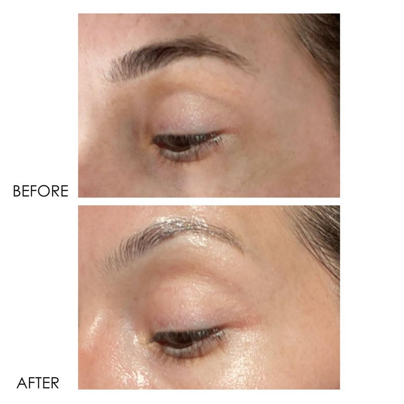 Dermelect Revitalite Eyelid & Dark Circle Corrector- Professional Strength, Anti-Aging Eye Cream with Peptides, Brightening & Tightening Ingredients- Dark Circles, Puffiness, Droopy Eyelids & Wrinkles - Image 4