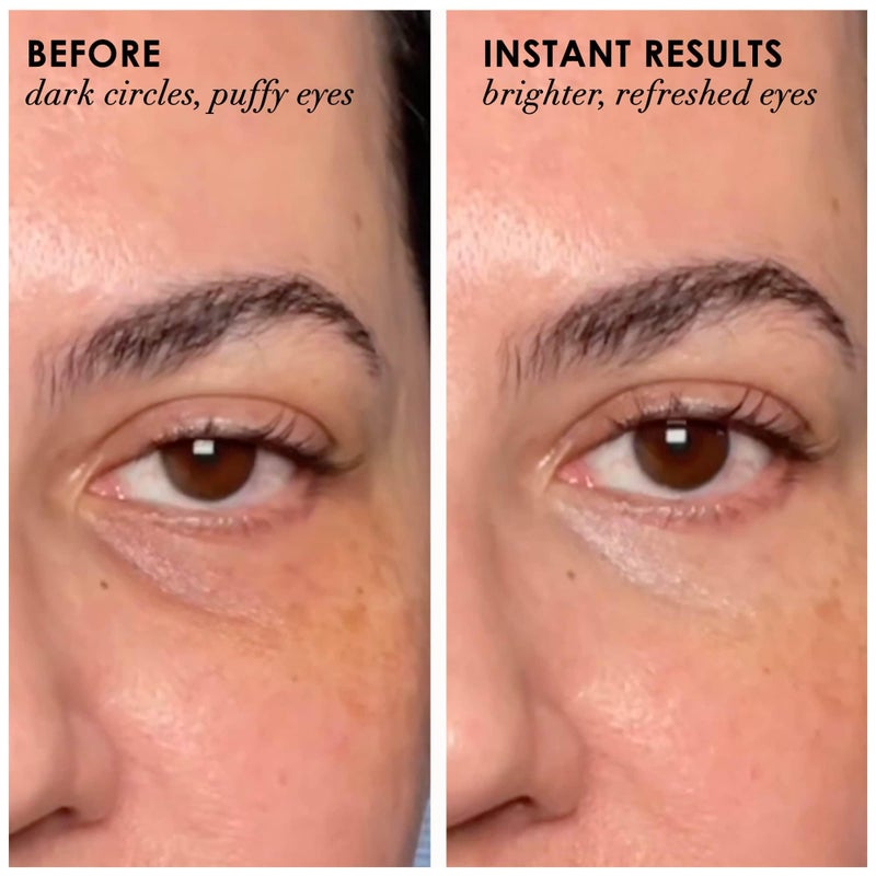Dermelect Revitalite Eyelid & Dark Circle Corrector- Professional Strength, Anti-Aging Eye Cream with Peptides, Brightening & Tightening Ingredients- Dark Circles, Puffiness, Droopy Eyelids & Wrinkles - Image 2