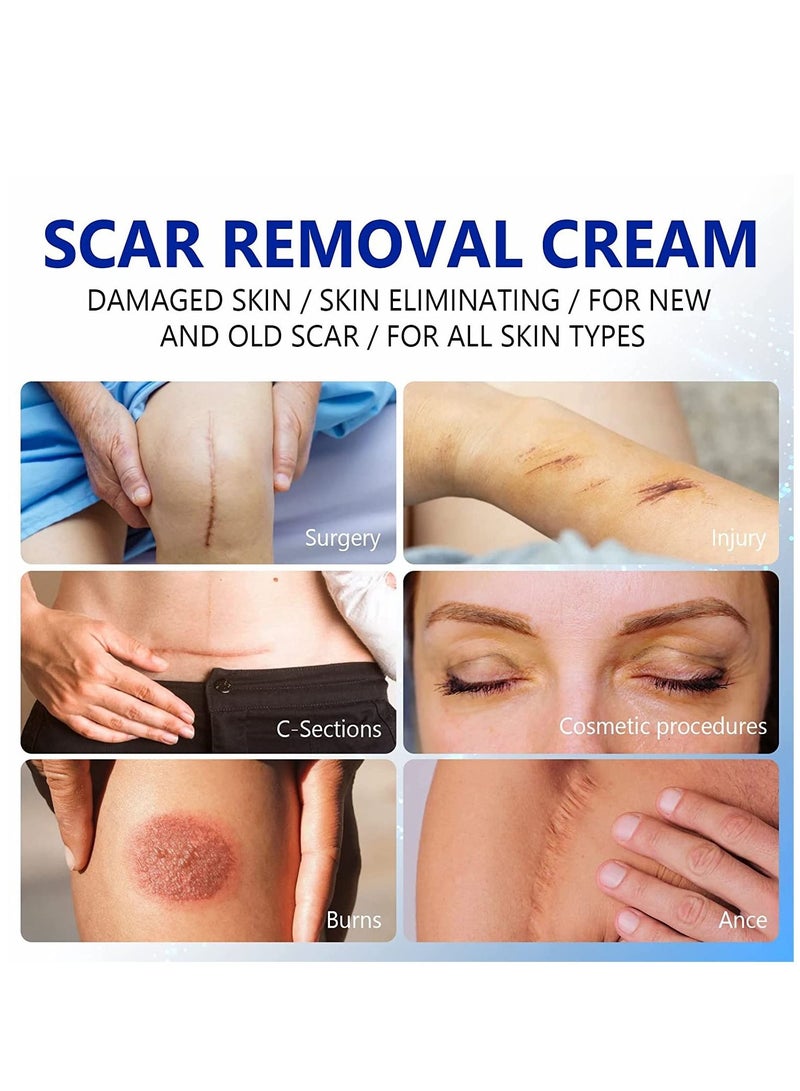 Elaimei كريم إزالة الندبات 50 مل، جل الندبات المتقدم - ينعم ويسطح الندبات الناتجة عن الجراحة والإصابات والحروق والعلاج الطبيعي للندبات للوجه والجسم - Image 3