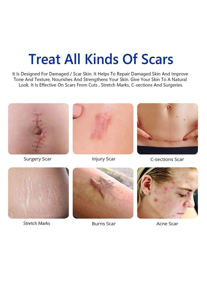 Elaimei كريم إزالة الندبات 50 مل، جل الندبات المتقدم - ينعم ويسطح الندبات الناتجة عن الجراحة والإصابات والحروق والعلاج الطبيعي للندبات للوجه والجسم - Image 5
