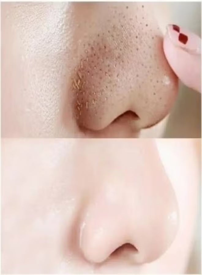شرائط تنظيف مسام الأنف بالكربون - 3 شرائط - Image 4
