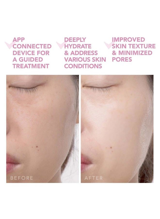 FOREO UFO 2 Supercharged Face Mask - Warming - Face Moisturizer - Dark Spot & Acne Scar Treatment for Face - Anti Aging – Nourishing - Pearl Pink - Image 5