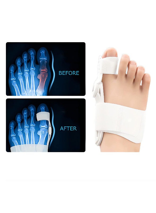 Bunion Corrector for Women and Men  Adjustable Bunion Splint with Silicone Inner Pad - Image 3