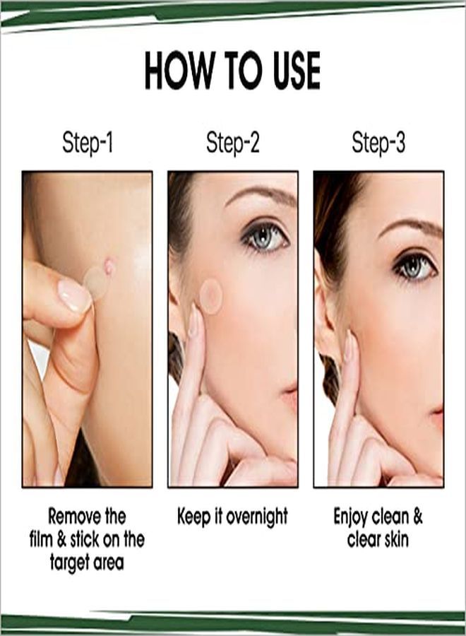 Urban yog Acne Pimple Patch - Invisible Facial Stickers Cover With 100% Hydrocolloid, Pimple / Acne Absorbing Patch (Pack Of 2)  - Image 3