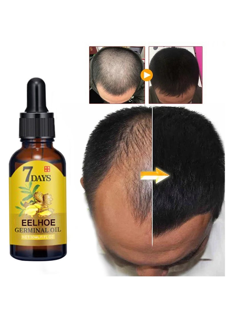 EELHOE 40ml Hair Nourishing Growth Solution, Moisturizing Fast Growth Anti-Defixation Spray Growth Solution, Organic Growth Plus Nourishing Ginger Solutionfor Men and Women - Image 2