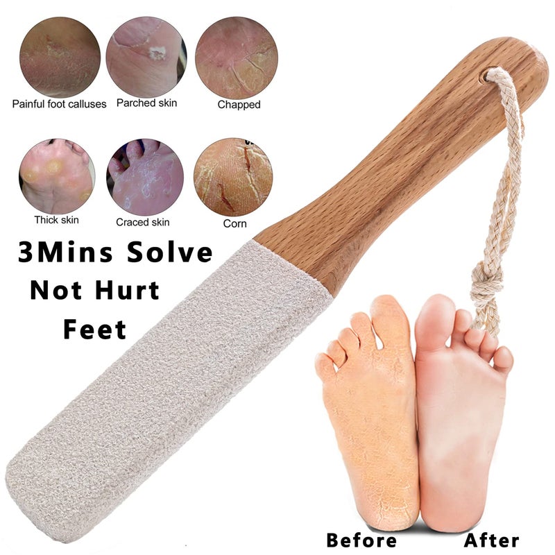 Kinepi Callus Remover Foot Scrubber Colossal Foot File Foot Care and Foot Exfoliator Foot Rasp Pedicure Tools Pumice Stone for Feet,Remove Corn Hard Skin Dead Skin for Use in Shower Foot Scraper Kit - Image 3