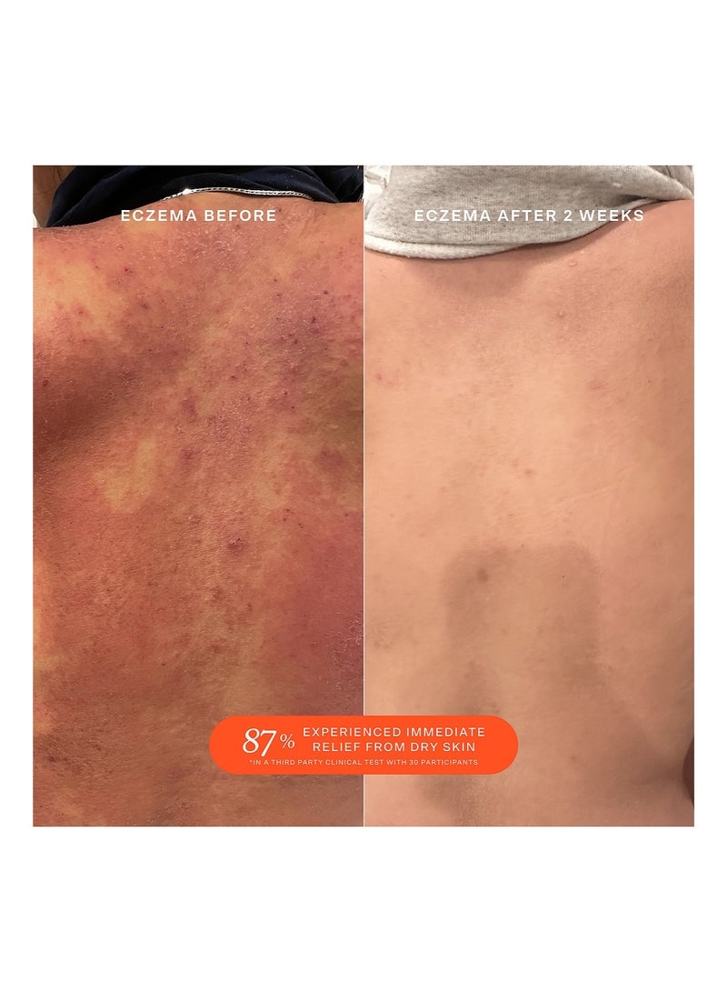 TOWER 28 Spray for the care of irritated and damaged skin_ 1 fl oz 30ml - Image 5