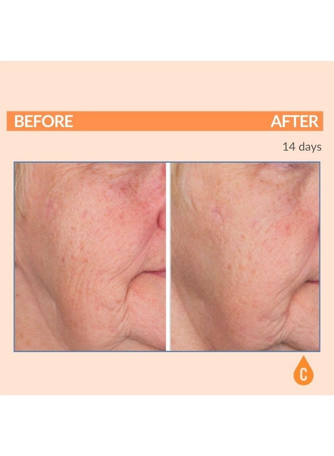 Serious Skincare C Serum Vitamin C Ester Skin Conditioner Antiaging Hydrating Softer Radiant Skin C3 Plasma Hydrolyzed Collagen For Fine Lines & Wrinkles 1 Oz. - Image 4