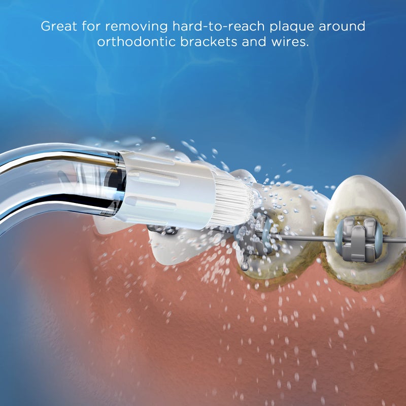 Oralphi Replacement Tips for Waterpik Water Flosser (2 Classic Jet Tips + 2 Orthodontic Tips + 2 Plaque Chaser Tips+ Storage Case Combo) - Image 2