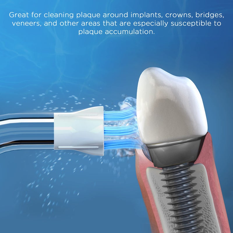 Oralphi Replacement Tips for Waterpik Water Flosser (2 Classic Jet Tips + 2 Orthodontic Tips + 2 Plaque Chaser Tips+ Storage Case Combo) - Image 3