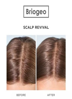 Briogeo Briogeo Scalp Revival™ Stimulating Therapy Massager - 63g  - Image 4