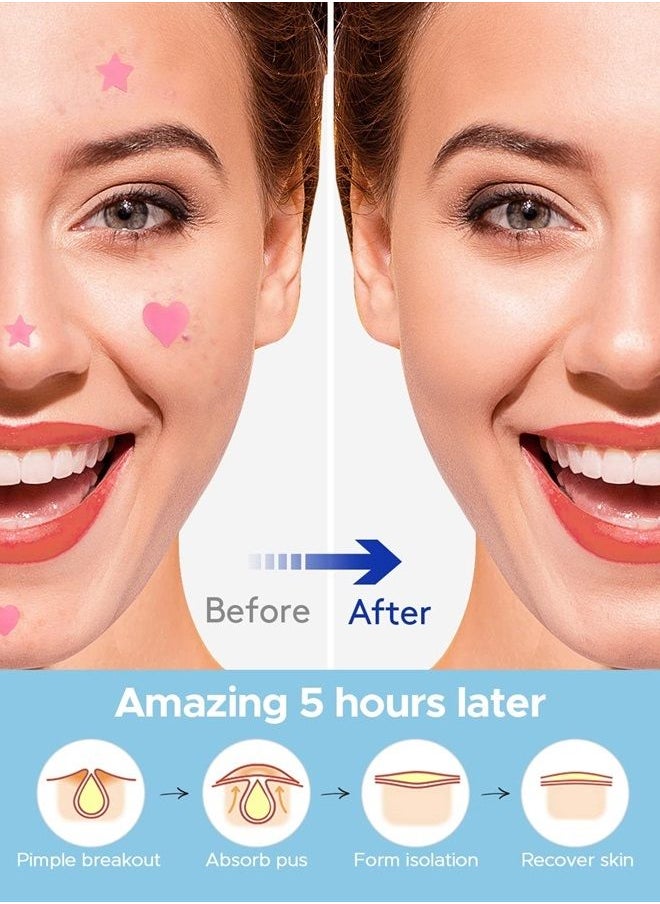 LitBear - Acne Patch Pimple Patch, Pink Heart & Star Shaped Absorbing Cover Hydrocolloid Patches For Face Zit, Acne Dots, Tea Tree Oil + Centella (108 Count (Pack of 1)) - Image 1