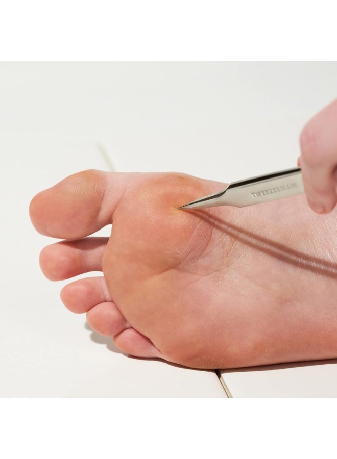 تويزرمان لإزالة الشعر الناشئ تحت الجلد Splintertweeze® - Image 4