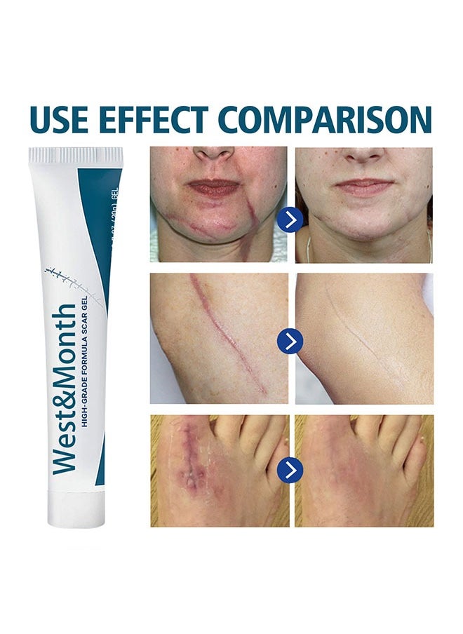 West&Month High-Grade Formula Scar Gel, Fade Scar Gel, Smooth Skin Care Gel,Scar Repair For Scar Pregnancy Surgery, 20g  - Image 2
