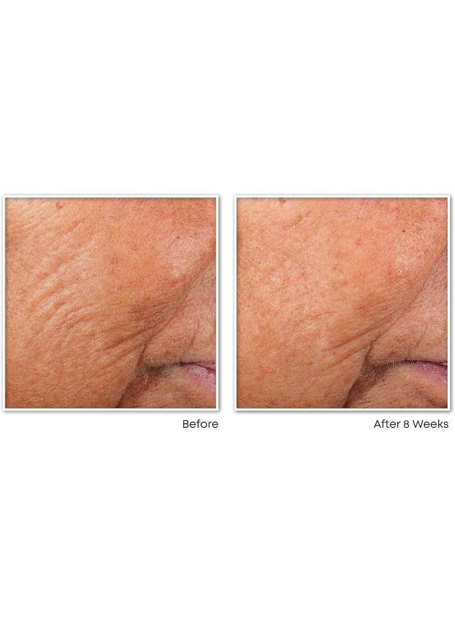 RoC كبسولات سيروم الليل لتنعيم الخطوط من ريتينول كوركسيون، علاج يومي لمكافحة الشيخوخة للبشرة للخطوط الدقيقة، البقع الداكنة، ندبات حب الشباب، 10 عد - Image 5