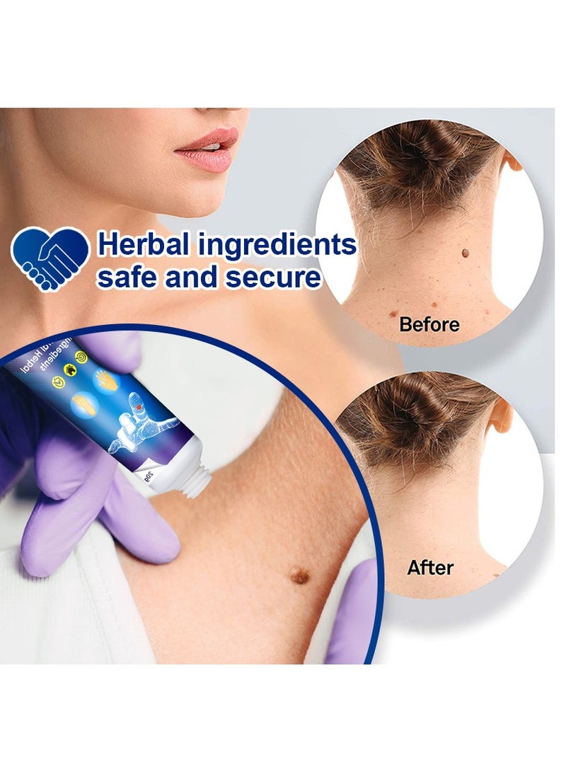 سوميفون مزيل البثور , مزيل البثور لإزالة الخلد والجلد على نحو سلس - Image 4