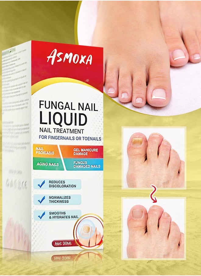 ASMOXA Fungal Nail Treatment Liquid 30ml Nail Fungus Treatment for Toenails & Fingernails Fungal Nail Renewal Anti Fungus Nail Repair Smooth & Hydrates Nail Reduce Discoloration  - Image 2